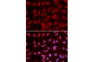 Immunofluorescence analysis of U2OS cells using SIN3A antibody. (SIN3A anticorps)