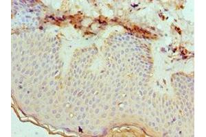 Immunohistochemistry of paraffin-embedded human skin tissue using ABIN7151879 at dilution of 1:100 (Ephrin B2 anticorps  (AA 28-229))