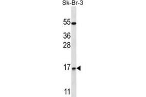 Western Blotting (WB) image for anti-NOTCH-Regulated Ankyrin Repeat Protein (NRARP) antibody (ABIN2997445) (NRARP anticorps)