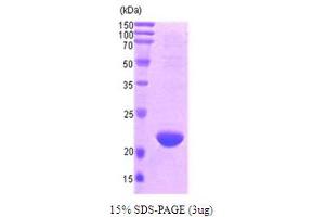 DIABLO Protein (AA 56-239) (T7 tag)