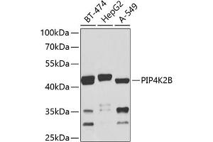 Western blot analysis of extracts of various cell lines, using PIP4K2B antibody (ABIN6130647, ABIN6145676, ABIN6145679 and ABIN6224039) at 1:1000 dilution. (PIP4K2B anticorps  (AA 1-270))