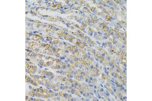 Immunohistochemistry of paraffin-embedded mouse stomach using CBL antibody (ABIN5995395) (40x lens). (CBL anticorps)