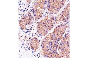 Immunohistochemical analysis of paraffin-embedded H. (PINK1 anticorps)