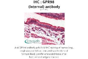 Image no. 1 for anti-G Protein-Coupled Receptor 98 (Gpr98) (Internal Region) antibody (ABIN1735202) (Gpr98 anticorps  (Internal Region))