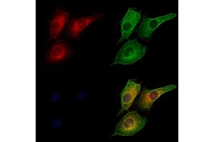 ABIN6260779 and ABIN6273207 staining HUVEC cells by IF/ICC. (CFHR3 anticorps  (Internal Region))
