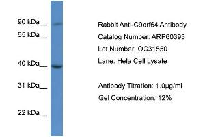 Western Blotting (WB) image for anti-Chromosome 9 Open Reading Frame 64 (C9orf64) (C-Term) antibody (ABIN2788433) (C9orf64 anticorps  (C-Term))