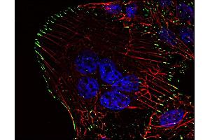 Phosphotyrosine pattern in HeLa cells as revealed by P-Tyr-01 antibody-Alexa Fluor ®  488 (green). (Phosphotyrosine anticorps)