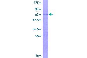 Image no. 1 for Ribosomal Protein L8 (RPL8) (AA 1-257) protein (GST tag) (ABIN1318670)