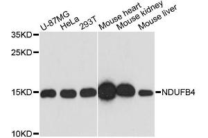 Western blot analysis of extracts of various cell lines, using NDUFB4 antibody. (NDUFB4 anticorps)