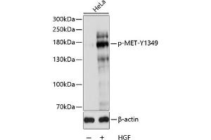 Western blot analysis of extracts of HeLa cells, using Phospho-MET-Y1349 antibody (ABIN3019529, ABIN3019530, ABIN3019531 and ABIN6225449) at 1:1000 dilution. (c-MET anticorps  (pTyr1349))