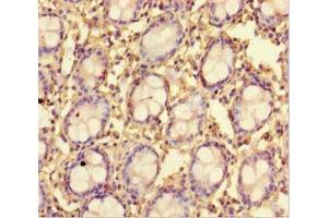 Immunohistochemistry of paraffin-embedded human colon tissue using ABIN7173015 at dilution of 1:100 (TMPRSS7 anticorps  (Ser7))