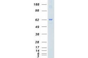Validation with Western Blot