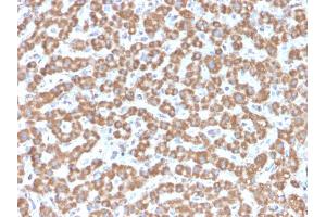 Formalin-fixed, paraffin-embedded human Liver stained with Prohibitin Mouse Monoclonal Antibody (PHB/3229). (Prohibitin anticorps  (AA 167-261))