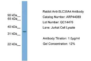 WB Suggested Anti-SLC35A4  Antibody Titration: 0. (SLC35A4 anticorps  (Middle Region))