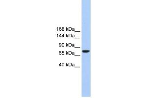 TMC2 antibody used at 1 ug/ml to detect target protein. (Tmc2 anticorps  (Middle Region))