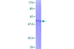 SDS-PAGE (SDS) image for Solute Carrier Family 25 (Mitochondrial Carrier, Adenine Nucleotide Translocator), Member 4 (SLC25A4) (AA 1-298) protein (GST tag) (ABIN1320296)