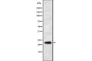 Western blot analysis IL17C using HT29 whole cell lysates (IL17C anticorps  (Internal Region))