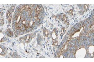 ABIN6276332 at 1/100 staining Human prostate tissue by IHC-P. (NEFL anticorps  (N-Term))