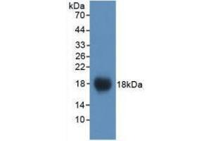 Western blot analysis of recombinant Mouse VCAM1. (VCAM1 anticorps  (AA 511-682))