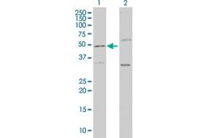 Western Blot analysis of LEPRE1 expression in transfected 293T cell line by LEPRE1 monoclonal antibody (M01), clone 3C7.