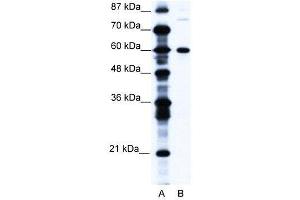 WB Suggested Anti-CNOT3 AntibodyTitration: 1. (CNOT3 anticorps  (N-Term))