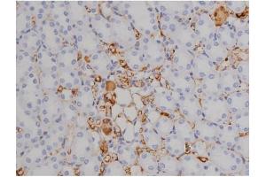 ABIN6267521 at 1/200 staining Rat kidney tissue sections by IHC-P.