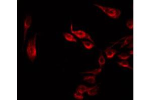 ABIN6274888 staining HT29 by IF/ICC.