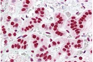 Human Adrenal (formalin-fixed, paraffin-embedded) stained with ACIN1 antibody ABIN461881 at 5 ug/ml followed by biotinylated goat anti-rabbit IgG secondary antibody ABIN481713, alkaline phosphatase-streptavidin and chromogen. (ACIN1 anticorps  (AA 775-789))
