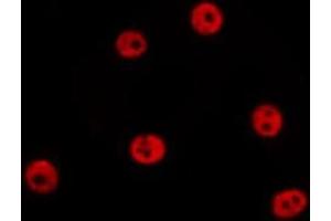 ABIN6278635 staining HepG2 by IF/ICC. (Sp2 anticorps  (C-Term))