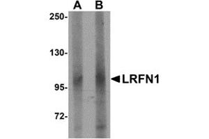 Western Blotting (WB) image for anti-Leucine Rich Repeat and Fibronectin Type III Domain Containing 1 (LRFN1) (C-Term) antibody (ABIN1030489)