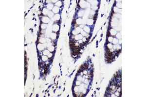 Immunohistochemistry of paraffin-embedded Human colon using SARNP Rabbit pAb (ABIN6130106, ABIN6147381, ABIN6147382 and ABIN6217793) at dilution of 1:100 (40x lens). (SARNP anticorps  (AA 1-210))