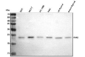 anti-RMI2, RecQ Mediated Genome Instability 2 (RMI2) (AA 23-147) antibody