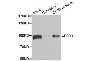 Immunoprecipitation analysis of 100ug extracts of 293T cells using 3ug DDX1 antibody. (DDX1 anticorps  (AA 441-740))