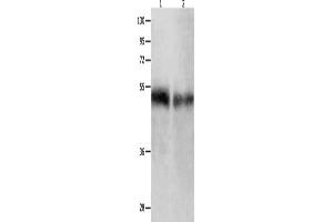 Gel: 10 % SDS-PAGE, Lysate: 50 μg, Lane 1-2: Human tongue tissue, Human laryngocarcinoma tissue, Primary antibody: ABIN7190003(BPIFB1 Antibody) at dilution 1/500, Secondary antibody: Goat anti rabbit IgG at 1/8000 dilution, Exposure time: 1 minute (BPIFB1 anticorps)