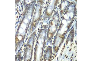 Immunohistochemistry of paraffin-embedded rat Intestine using Septin 7 antibody (ABIN1682655, ABIN3018092, ABIN3018093 and ABIN6220357) at dilution of 1:100 (40x lens). (7-Sep (AA 307-436) anticorps)