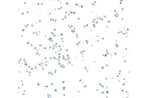 Immunocytochemistry (ICC) image for anti-SRY (Sex Determining Region Y)-Box 2 (SOX2) antibody (ABIN7449421)
