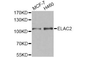 Western blot analysis of extracts of various cell lines, using ELAC2 Antibody. (ELAC2 anticorps)