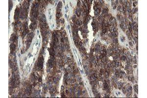 Image no. 2 for anti-Eukaryotic Translation Initiation Factor 5A2 (EIF5A2) antibody (ABIN1497996)