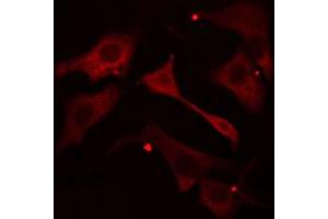 ABIN6272362 staining HepG2 cells by IF/ICC.