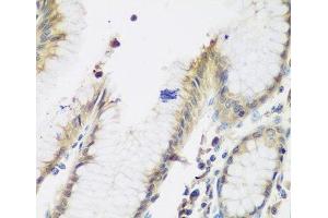 Immunohistochemistry of paraffin-embedded Human stomach using NAA50 Polyclonal Antibody at dilution of 1:200 (40x lens). (NAA50 anticorps)