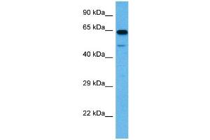Host:  Rat  Target Name:  SLC1A2  Sample Tissue:  Rat Brain  Antibody Dilution:  1ug/ml