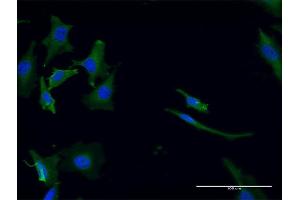 Immunofluorescence of monoclonal antibody to GPT2 on HeLa cell.