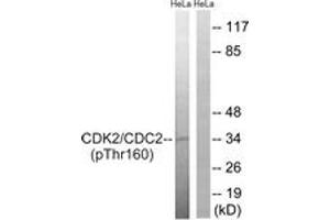 Western blot analysis of extracts from HeLa cells, using CDC2 (Phospho-Thr161) Antibody. (CDK1 anticorps  (pThr161))