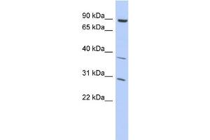 WB Suggested Anti-KLHL5 Antibody Titration:  0. (KLHL5 anticorps  (Middle Region))