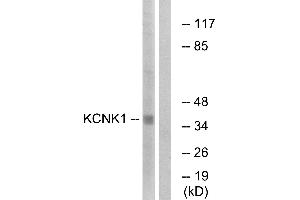 Western blot analysis of extracts from Jurkat cells, using KCNK1 antibody. (KCNK1 anticorps  (Internal Region))