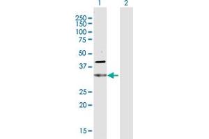 Western Blot analysis of CDC34 expression in transfected 293T cell line by CDC34 MaxPab polyclonal antibody. (CDC34 anticorps  (AA 1-236))