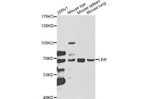 Western blot analysis of extracts of various cell lines, using LBR antibody (ABIN5973181) at 1/1000 dilution. (Lamin B Receptor anticorps)