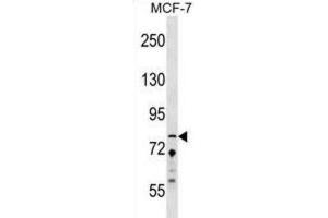 Western Blotting (WB) image for anti-Zinc Finger Protein 828 (ZNF828) antibody (ABIN2999729) (ZNF828 anticorps)