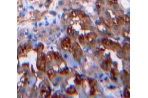 Used in DAB staining on fromalin fixed paraffin-embedded Kidney tissue (Leptin anticorps  (AA 22-167))