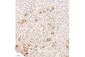 Immunohistochemistry of paraffin embedded mouse hypophysis using Galanin (ABIN7074010) at dilution of 1:500 (400x lens) (Galanin anticorps)